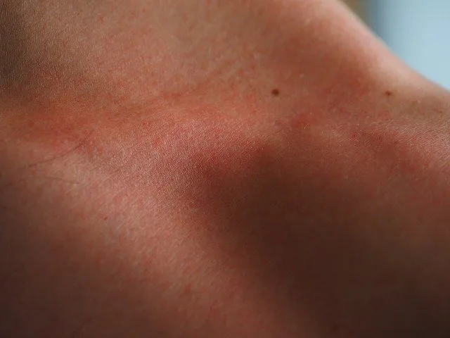 Reactive Skin