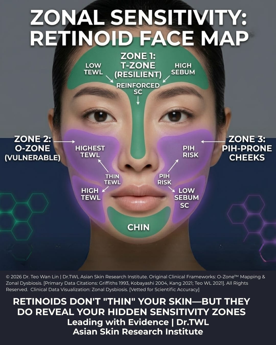 Retinoids Zonal Sensitivity Face Map