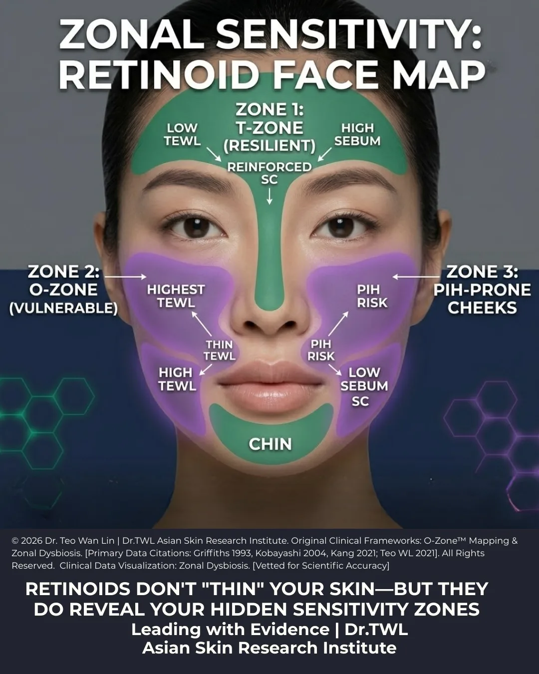 Zonal Sensitivity: Retinoids Face Map